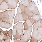 Immunohistochemical staining of human skeletal muscle shows moderate nuclear and cytoplasmic positivity in striated muscle fibers.