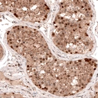 Immunohistochemical staining of human testis shows moderate to strong nuclear positivity in cells in seminiferous ducts.
