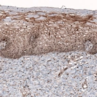 Immunohistochemical staining of human uterine cervix shows moderate nuclear and membranous positivity in squamous epithelial cells.