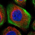 Immunofluorescent staining of human cell line A-431 shows localization to cytosol & actin filaments.