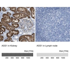 Anti-ASS1 Antibody