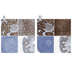 Immunohistochemical staining of human kidney, liver, lymph node and skin using Anti-ASS1 antibody HPA020934 (A) shows similar protein distribution across tissues to independent antibody HPA020896 (B).