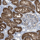 Immunohistochemical staining of human kidney shows strong cytoplasmic positivity in cells in proximal tubules.