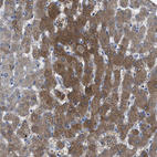 Immunohistochemical staining of human liver shows strong cytoplasmic positivity in hepatocytes.