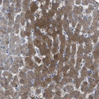 Immunohistochemical staining of human liver shows strong cytoplasmic positivity in hepatocytes.