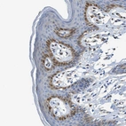 Immunohistochemical staining of human skin shows moderate cytoplasmic positivity in a subset of squamous epithelial cells.