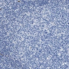 Immunohistochemical staining of human lymph node shows no cytoplasmic positivity in germinal center cells as expected.