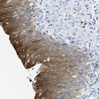 Immunohistochemical staining of human urinary bladder shows strong cytoplasmic positivity in urothelial cells.