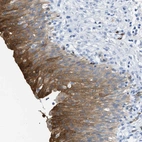 Immunohistochemical staining of human urinary bladder shows strong cytoplasmic positivity in urothelial cells.