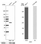 Western blot analysis in human cell lines MCF-7 and U-251MG using Anti-ASS1 antibody. Corresponding ASS1 RNA-seq data are presented for the same cell lines. Loading control: Anti-GAPDH.
