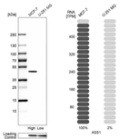 Western blot analysis in human cell lines MCF-7 and U-251MG using Anti-ASS1 antibody. Corresponding ASS1 RNA-seq data are presented for the same cell lines. Loading control: Anti-GAPDH.
