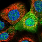 Immunofluorescent staining of human cell line A-431 shows localization to nucleoplasm & cytosol.