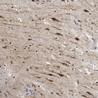 Anti-ZMYND8 Antibody