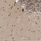 Immunohistochemical staining of human cerebellum shows moderate positivity in cells in molecular layer.