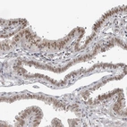Immunohistochemical staining of human fallopian tube shows moderate nuclear positivity in glandular cells.