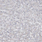 Immunohistochemical staining of human liver shows no positivity in hepatocytes as expected.