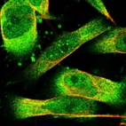 Immunofluorescent staining of human cell line U-251 MG shows localization to nuclear bodies & cytosol.