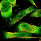 Immunofluorescent staining of human cell line U-251 MG shows localization to nuclear bodies & cytosol.