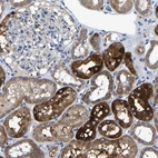 Immunohistochemical staining of human kidney shows strong cytoplasmic positivity in cells in tubules.