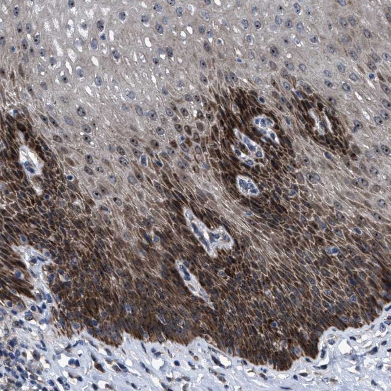 Anti-HAUS6 Antibody