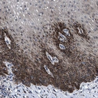 Anti-HAUS6 Antibody