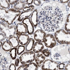 Immunohistochemical staining of human kidney shows strong granular cytoplasmic positivity in cells in tubules.