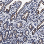 Immunohistochemical staining of human duodenum shows strong granular cytoplasmic positivity in glandular cells.