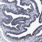 Immunohistochemical staining of human fallopian tube shows moderate granular cytoplasmic positivity in glandular cells.