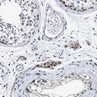 Immunohistochemical staining of human testis shows strong granular cytoplasmic positivity in Leydig cells.