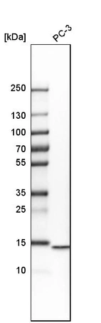 Western blot analysis in human cell line PC-3.