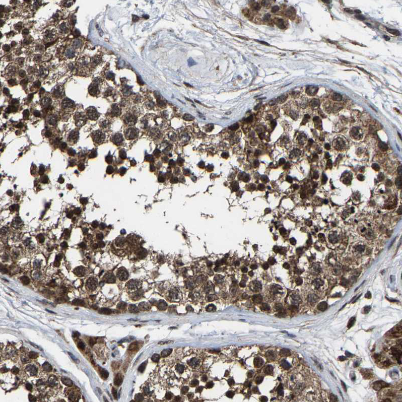 Anti-HAUS6 Antibody