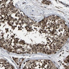 Anti-HAUS6 Antibody