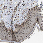 Immunohistochemical staining of human skin shows moderate nuclear and cytoplasmic positivity in squamous epithelial cells.