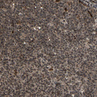 Immunohistochemical staining of human tonsil shows moderate nuclear and cytoplasmic positivity in germinal center cells.