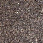 Immunohistochemical staining of human tonsil shows moderate nuclear and cytoplasmic positivity in germinal center cells.