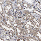Immunohistochemical staining of human kidney shows weak granular cytoplasmic positivity in cells in tubules.