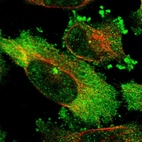 Immunofluorescent staining of human cell line U-251 MG shows localization to nuclear speckles, cytosol & microtubule organizing center.