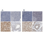 Immunohistochemical staining of human lymphoid tissues, pancreas, skeletal muscle and testis using Anti-MURC antibody HPA020973 (A) shows similar protein distribution across tissues to independent antibody HPA020987 (B).