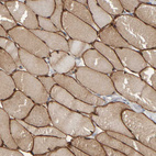 Immunohistochemical staining of human skeletal muscle shows strong membranous positivity in myocytes.
