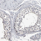 Immunohistochemical staining of human testis shows weak cytoplasmic positivity in cells in seminiferous ducts.