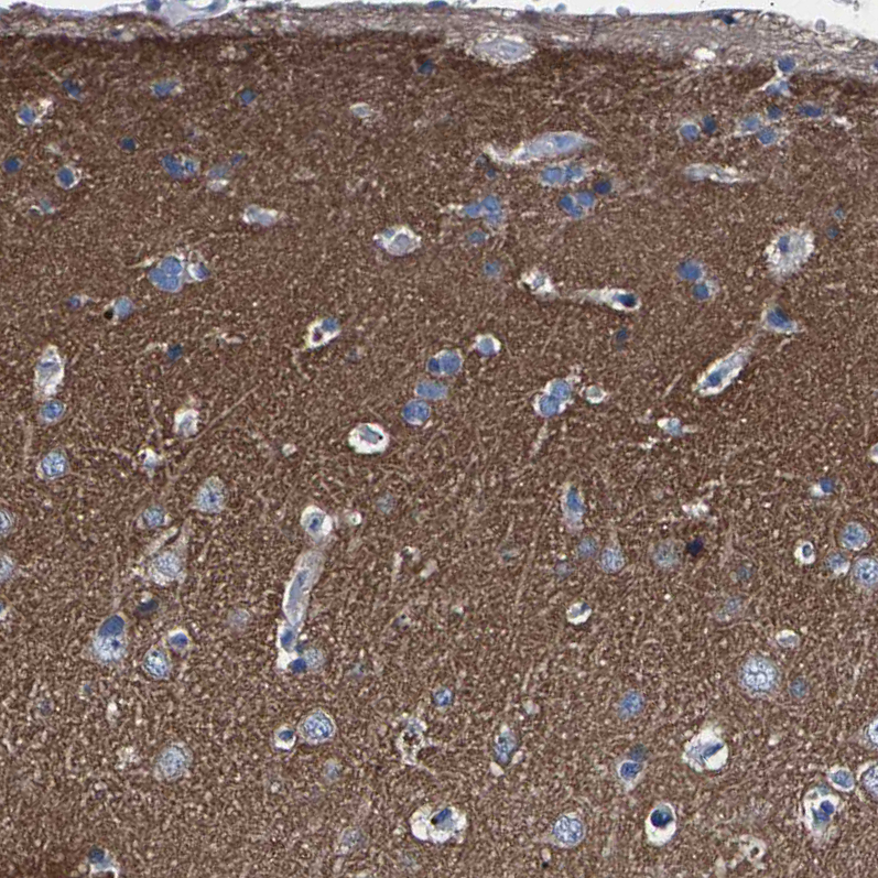 Anti-PHF24 Antibody