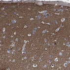 Anti-PHF24 Antibody
