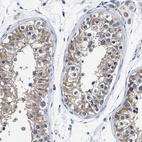 Immunohistochemical staining of human testis shows moderate cytoplasmic positivity in cells in seminiferous ducts.