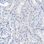 Immunohistochemical staining of human kidney shows no positivity in cells in tubules as expected.
