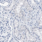 Immunohistochemical staining of human kidney shows no positivity in cells in tubules as expected.