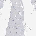 Immunohistochemical staining of human skeletal muscle shows no positivity in myocytes as expected.