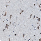 Anti-NACAD Antibody