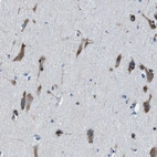 Immunohistochemical staining of human cerebral cortex shows high expression.