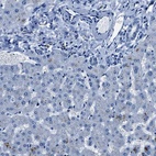 Anti-NACAD Antibody