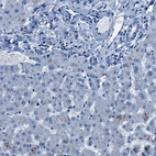 Immunohistochemical staining of human liver shows low expression as expected.